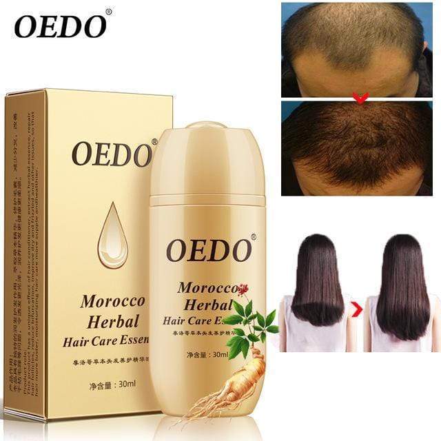 OEDO™: Essence de croissance de cheveux du Maroc